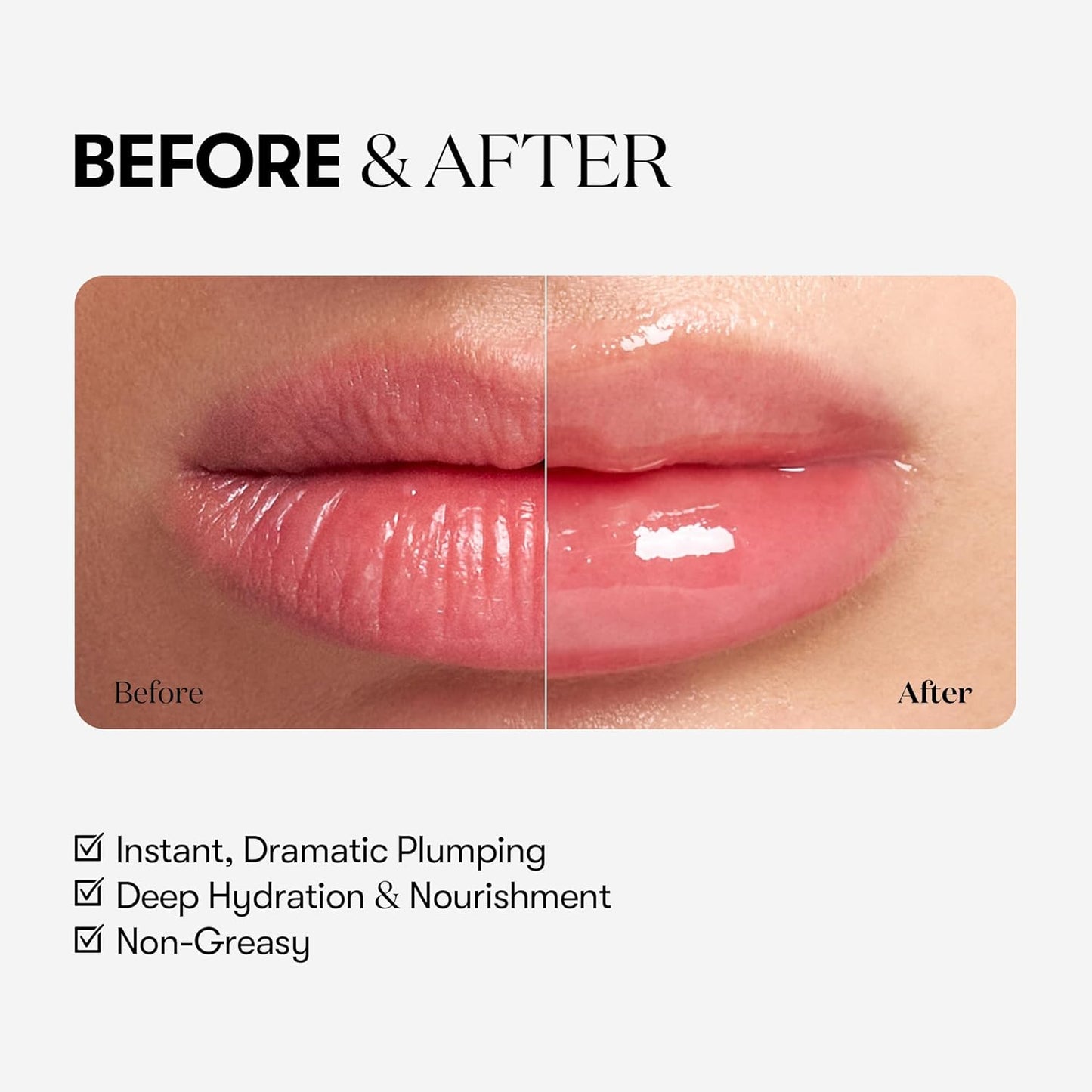 VT - Reedle Shot Lip Plumper Expert
