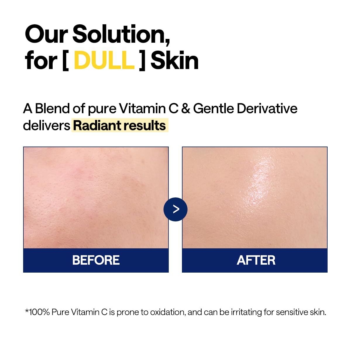 Mediheal - Vitamin C Brightening Serum