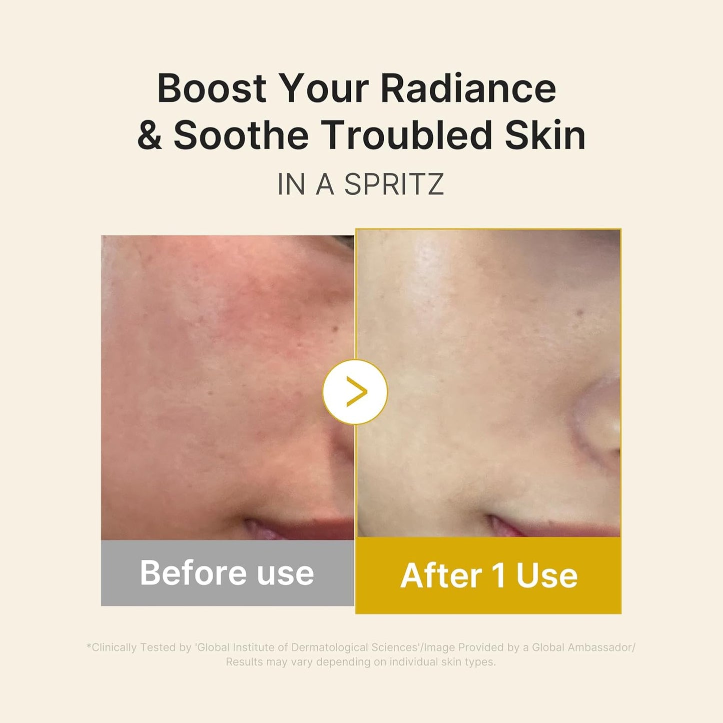 Medicube - Kojic Acid Turmeric Vitamin Gold Jelly Mist Serum