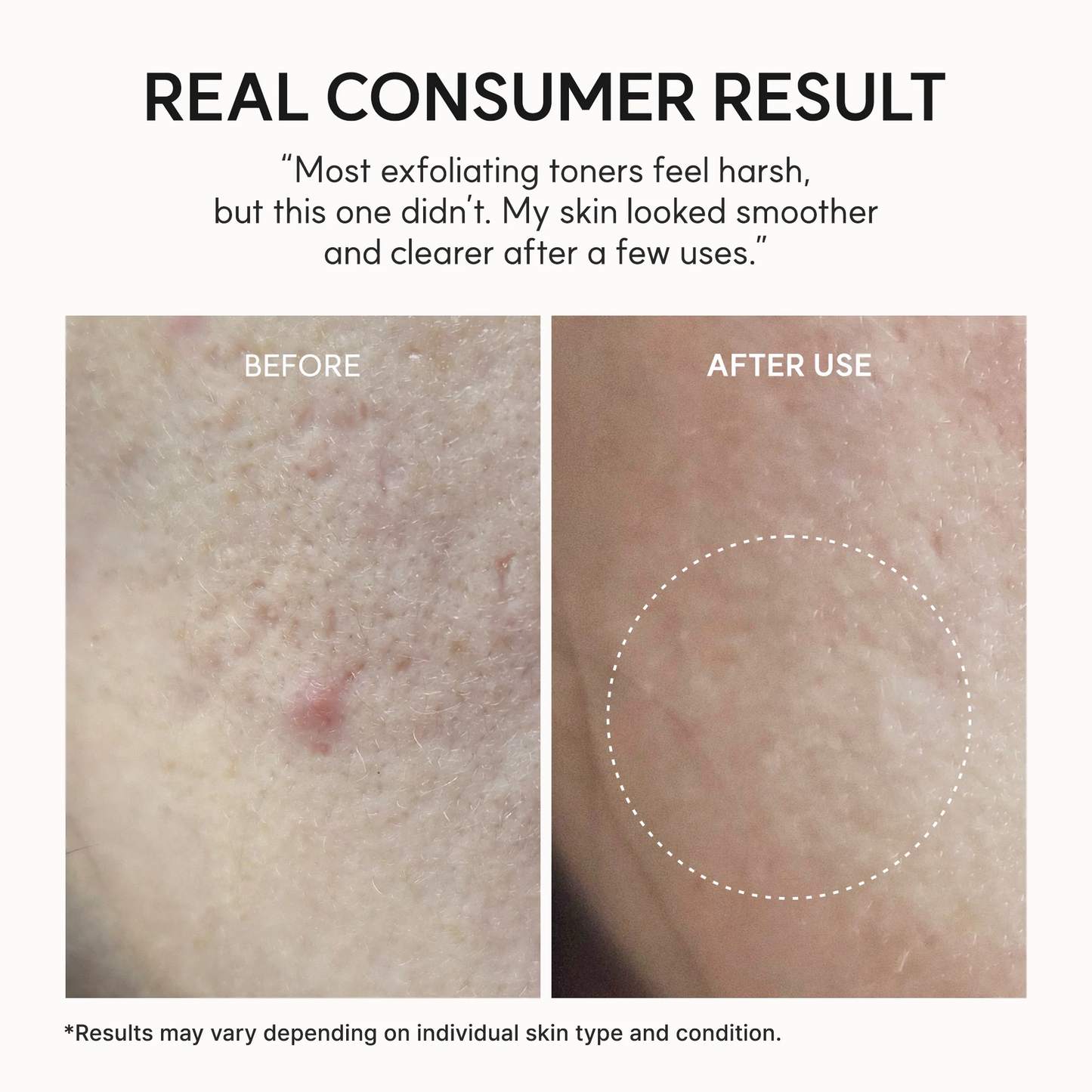 Arencia - Eraser Shot Glycolic Acid Exfoliator