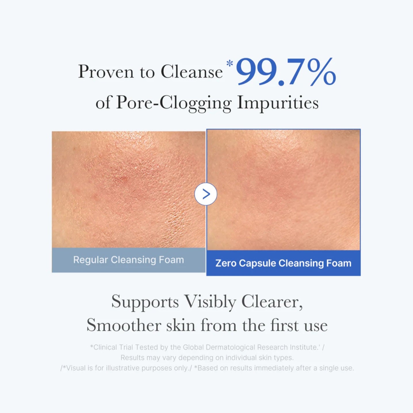 Medicube - Zero Pore SA Clear Capsule Cleansing Foam
