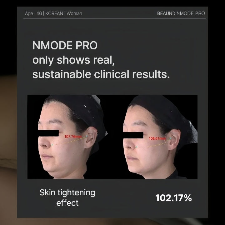 Beaund - Nmode Pro Pink Edition